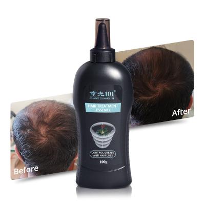 China Chinese Herb Extracts Best Anti Hair Loss Prevention Supplier Oil Loss For Business Man for sale