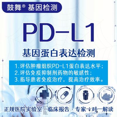 中国 PD-L1 タンパク質発現 E1L3N 健康のための最良の遺伝子検査 販売のため