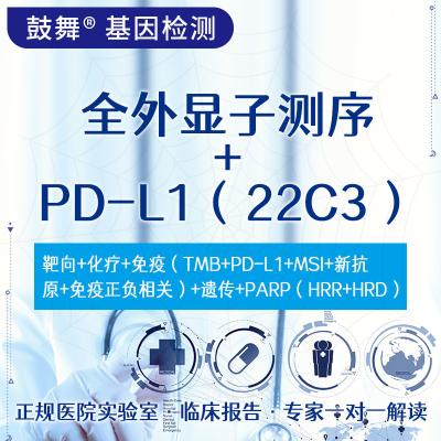 중국 NGS+IHC 전체 외종 염기서열 검사 +PD-L1 (22C3) 패키지 판매용