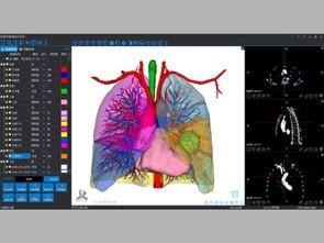 China Medical 3D reconstruction and 3D printing services for sale