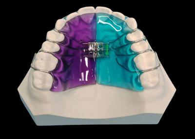 Chine Expansor amovible pour un traitement orthodontique efficace et une amélioration du sourire à vendre