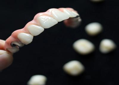 China Solução Estética Implante Dental Ponte da Coroa Para Adultos Substituindo Dentes Faltantes à venda