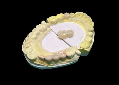 China Precise Fit Ceramic Bridge Dental , Translucency Ceramic Crown And Bridge for sale