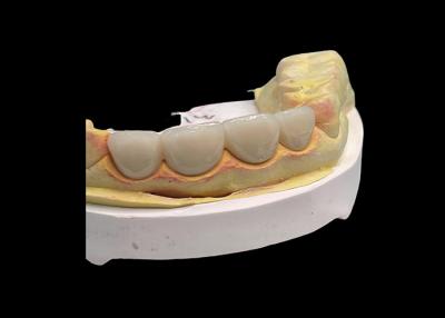 China Verschleißbeständigkeit Alle Keramikkronenbrücke mit ausgezeichneter Biokompatibilität zu verkaufen