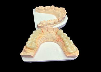 China Natural Aesthetics Translucent Ceramic Crown Tooth For Dental Restoration Easy Cleaning for sale