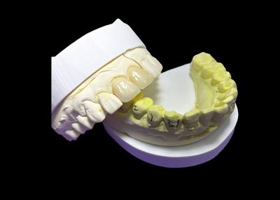 China Durability Wear Resistant All Ceramic Bridges , Ceramic Dental Bridge Customized for sale