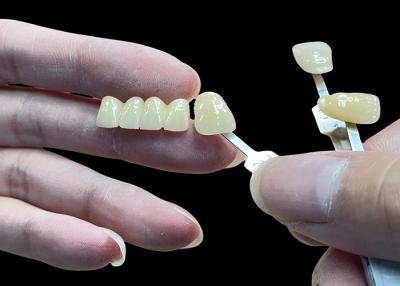 China Resistente a manchas Todas as pontes de porcelana confortável adequado para restauração dentária à venda