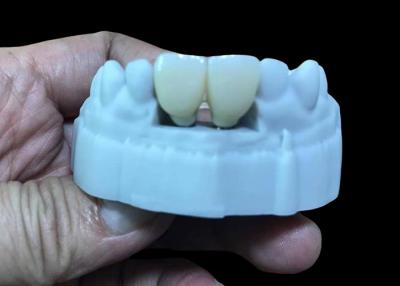 China Substitua a coroa do implante dentário com uma base de titânio e coroa de zircônio. à venda