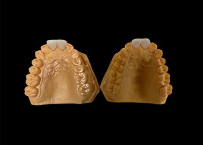 China Customized Aesthetic Zirconia Crown , Perfectly Fit Zirconia Crown For Anterior Teeth for sale