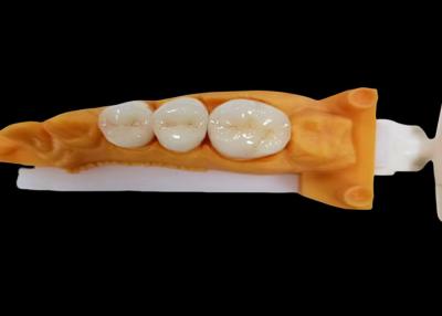 China Resistencia al desgaste Circónia Corona dental Chips y manchas Resistencia a la estética natural en venta