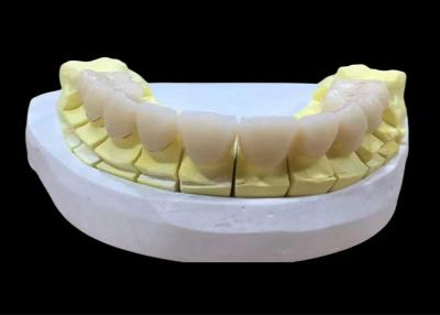 China Estética, aspecto natural, corona completa de zirconio, corona dental, material de zirconio. en venta