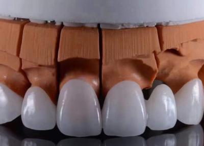 China Las coronas de zirconia translúcidas, ajustadas con una apariencia estética natural, aprobadas por la FDA. en venta