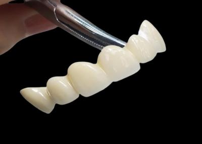 China Corona dental de zircónia translúcida a medida con alta durabilidad resistente a manchas en venta