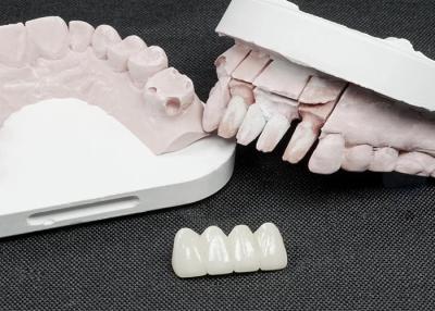 China Premium Zirconia tandkronen voor superieure sterkte en natuurlijke esthetiek Te koop