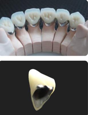 China Porcelain Fused To Metal PFM Crown Dental Wear Resistance For Restorative Dentistry for sale