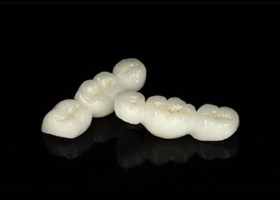 China Corona dental de zirconia de aspecto natural translúcida con excelente durabilidad y ajuste preciso en venta