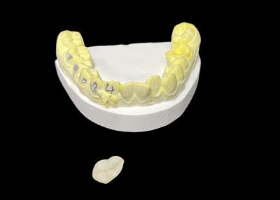 China Solución de reparación de dientes dañados en venta