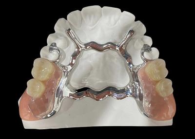 China Metal Base and Acrylic Resin Partial Removable Denture for a Secure Fit and Natural Appearance for sale