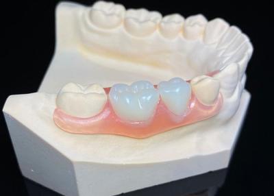 China Dentadura extraíble invisible, prótesis dental, dentadura parcial de resina acrílica en venta