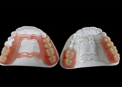 China Partial Removable Denture , removable dental prosthesis For Chewing And Speaking for sale