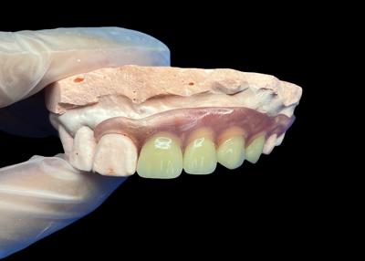 China Invisible Flexible Partial dentures for Comfortable Secure Fit and Natural Aesthetics for sale