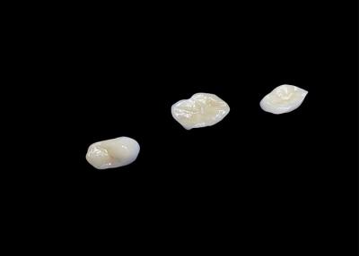 Cina Infissi e infissi in ceramica biocompatibili progettati per una durabilità confortevole e un'integrazione senza soluzione di continuità con i denti naturali in vendita