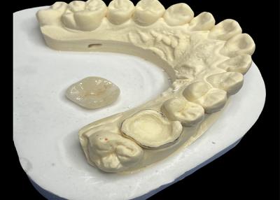 China Ceramic Dental Inlay Onlay For Teeth Repair , Dental Solution Porcelain Inlay Onlay for sale