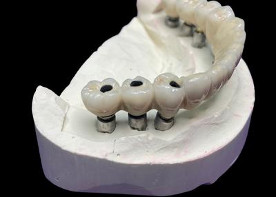 China O implante dentário com uma base de titânio é coberto com uma bela ponte de coroa de cerâmica para criar uma restauração perfeita. à venda