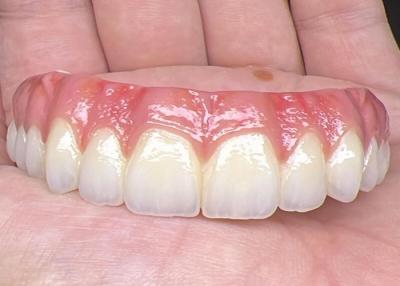 China Saúde Oral Implante Dental Dentes dentários apoiados Ponte Superfície polida Suporte Dentes dentários completos à venda