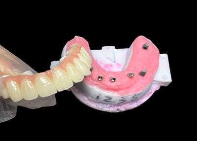 China Implant supported Full Arch Denture Fixed Dental implant Ceramic Crown Bridge for sale