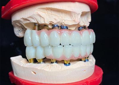 China Implante dental de base de titânio polido ponte de coroa cerâmica para restauração dental à venda