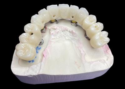 China Titanium Base Ceramic Crown Hygiene Dental Crown Bridge System Polished Design for sale