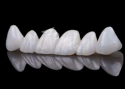 China Natuurlijke uitstraling Zirconia tandkroon Vlekwerend Alle Zirconia kroon Te koop