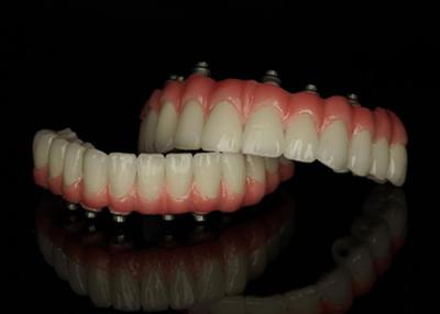 China Dentes postizos con base de titanio con implantes fijos con puente de corona de cerámica para reemplazar los dientes perdidos en venta