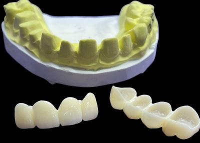 China Stain Resistant Dental Porcelain Crown Bridge , All Ceramic Bridges Vita Classical Shade for sale