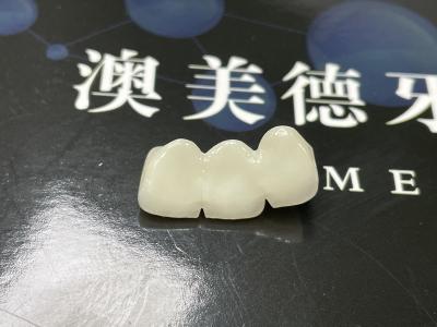 China Ponte de coroa cerâmica de ajuste preciso com porcelana forte e translucidez estética natural à venda