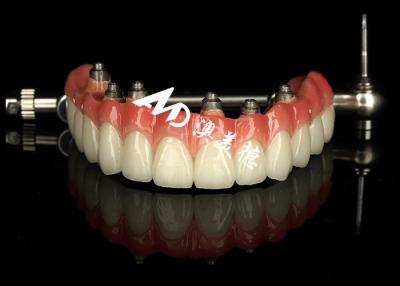 China Customized Dental Implant supported dentures Crown Bridge For Missing Teeth Maintenance for sale