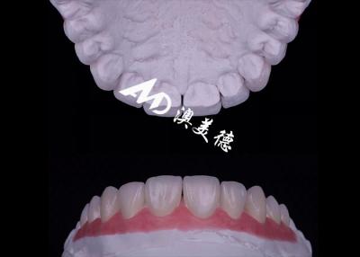 China Translucidez Veneer de porcelana EMAX Resistente a las manchas / resistencia en venta