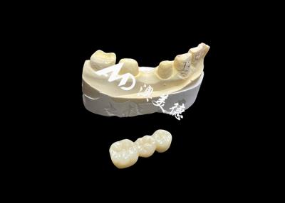 Chine Couronne dentaire en zirconium esthétique de haute dureté avec translucide et résistance aux fissures du laboratoire dentaire chinois à vendre