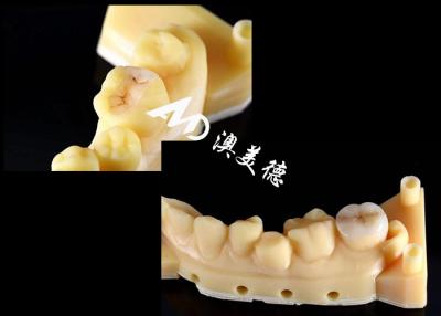 China Color natural Precisión Intracciones cerámicas Intracciones Dentes hipoalergénicos en venta