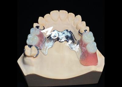 China Removable Denture with Cast Metal Framework for Superior Strength and Stability with Long Lasting Comfort for sale