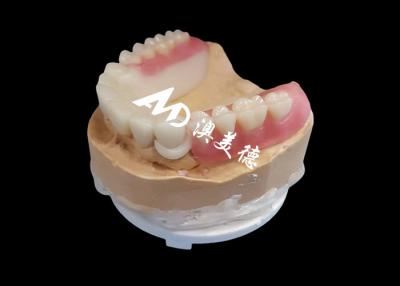 China Customized Hpp Frame Acrylic Removable Partial Denture For Missing Teeth for sale