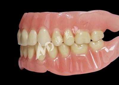 China Affordable Full Arch Acrylic Dentures for Comfortable Removable Dentures for sale