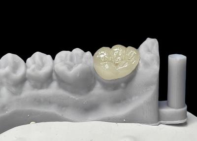 China Enlaces cerámicos dentales de ajuste preciso, enlaces de porcelana y enlaces aprobados por la FDA. en venta