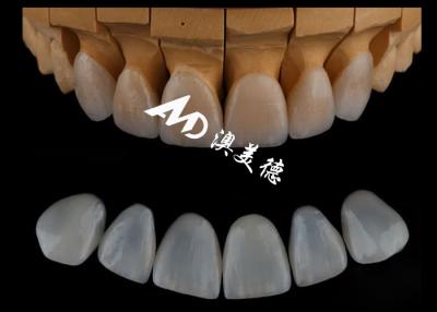 China Highly Accurate Customized Emax Porcelain Veneers For Cosmetric Dentistry for sale