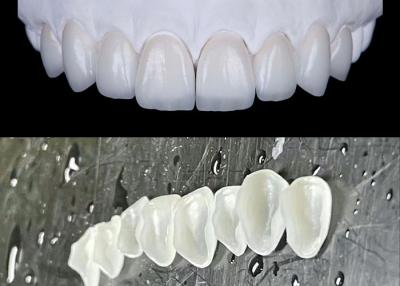 China 0.3-0.5mm Thick Beautiful Looking Emax Porcelain Veneers For Dental Restorations for sale