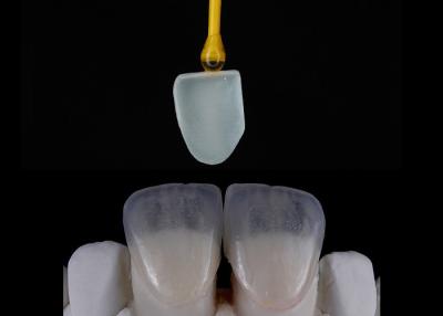 China Restauración dental hecha a medida Veneers EMAX Impresión digital bellamente alineada en venta