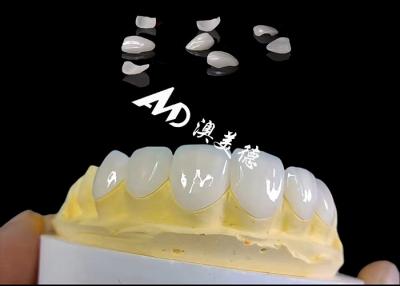 China Translucidez Ips E Max Carillas, Preparación mínima Emax Carillas dentales en venta