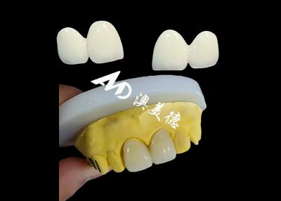 China Custom Zirconia tandheelkundige kroon Precise Fit Tand Cap uit China tandheelkundig lab Te koop