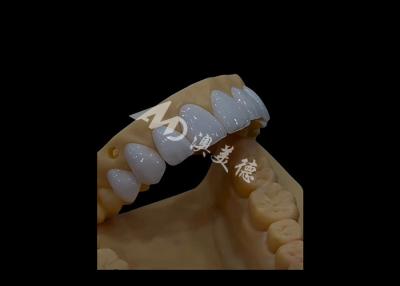 Chine Prothèses dentaires Circonia Couronne dentaire Précise esthétique pour les dents à arc complet à vendre